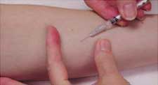 Injection site