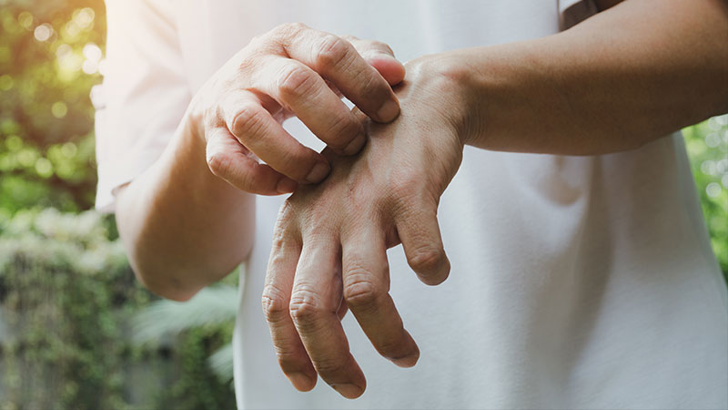 person scratching hand