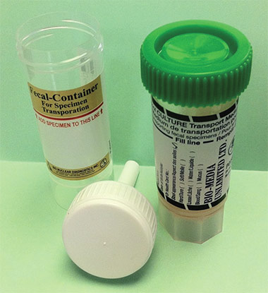 Photo of Stool sample collection containers