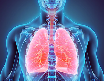 Illustration of lungs affected by blastoymcosis