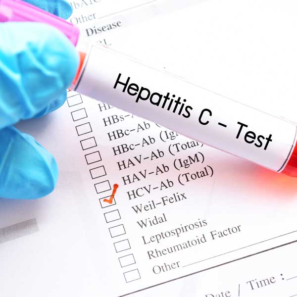 hep c test