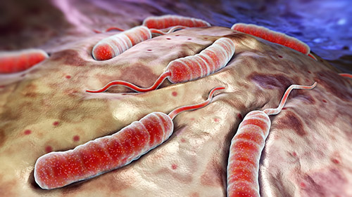 Microscopic photo of cholera
