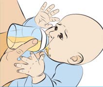 Illustration of baby showing signs of distress while feeding