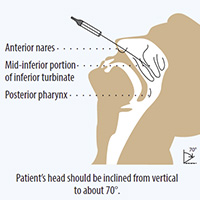 Photographic instruction on taking a nasopharyngeal swab